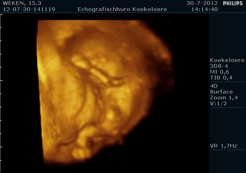 http://i18.photobucket.com/albums/b115/MissyNikie/Zwanger/12-07-30-141119_WEKEN_20120730_141120_0003.jpg
