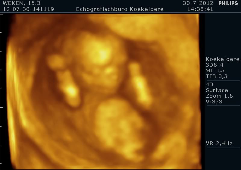 http://i18.photobucket.com/albums/b115/MissyNikie/Zwanger/12-07-30-141119_WEKEN_20120730_141120_0044.jpg