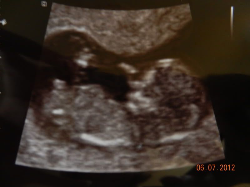 http://i18.photobucket.com/albums/b115/MissyNikie/Zwanger/DSCN4070.jpg