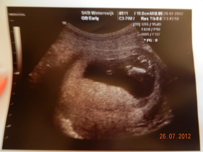 http://i18.photobucket.com/albums/b115/MissyNikie/Zwanger/DSCN4178.jpg