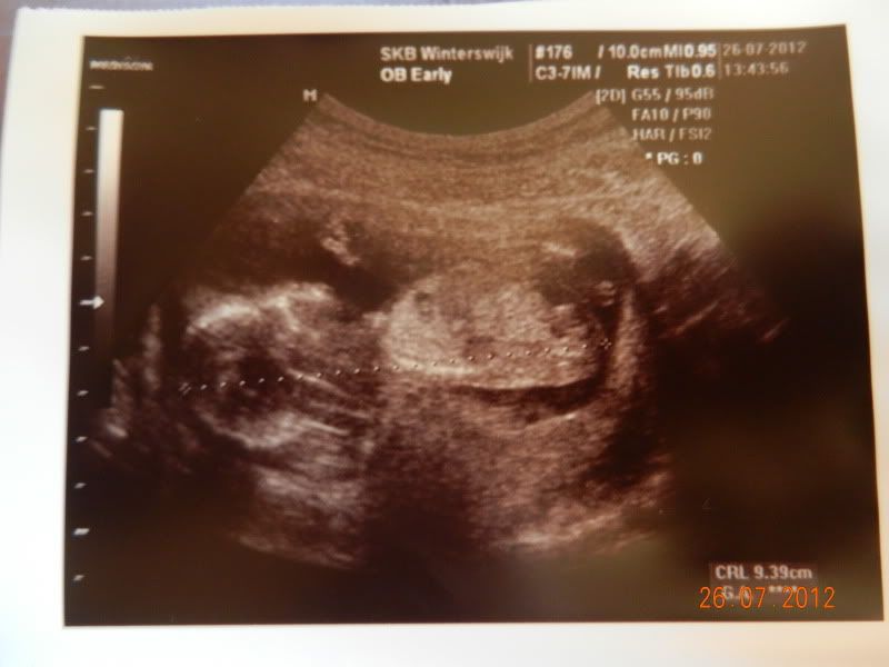 http://i18.photobucket.com/albums/b115/MissyNikie/Zwanger/DSCN4182.jpg
