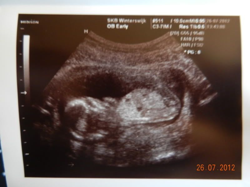 http://i18.photobucket.com/albums/b115/MissyNikie/Zwanger/DSCN4183.jpg