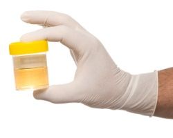 image of a specimen cup with urine