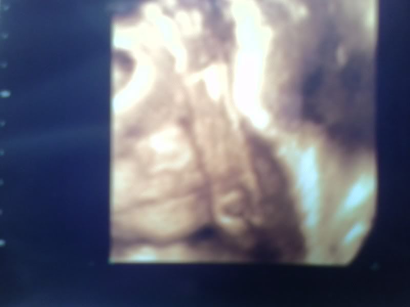 3d ultrasound pictures at 26 weeks. 26 weeks and 1 day