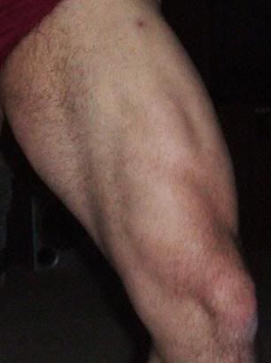 4_30_06leftleg2.jpg