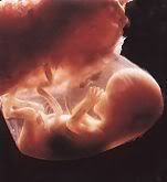 16 week old fetus