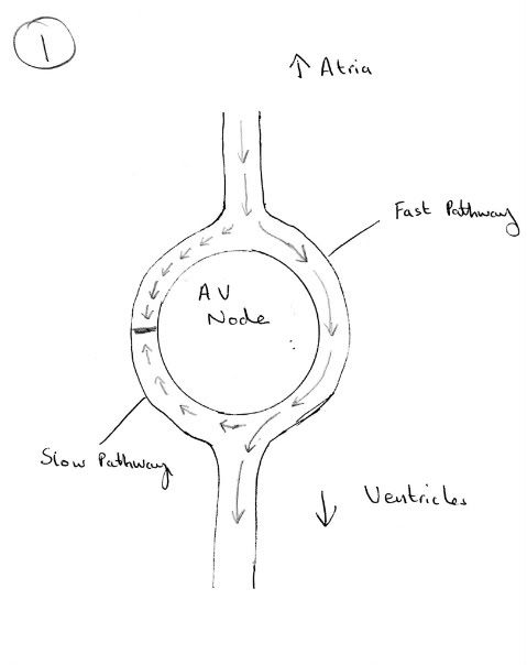 Slow Action Potential